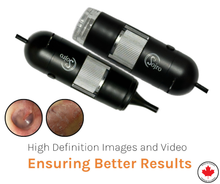 Load image into Gallery viewer, Oto-Dermascope: Advanced Digital Otoscope & Dermascope for Medical Professionals with image capturing and video recording