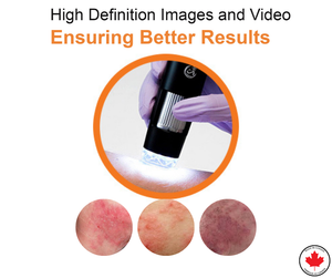 Oto-Dermascope: Advanced Digital Otoscope & Dermascope for Medical Professionals with image capturing and video recording