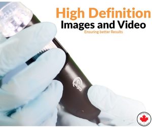 Oto-Dermascope: Advanced Digital Otoscope & Dermascope for Medical Professionals with image capturing and video recording