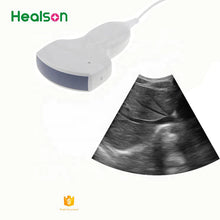 Load image into Gallery viewer, Convex Portable Ultrasound Probe
