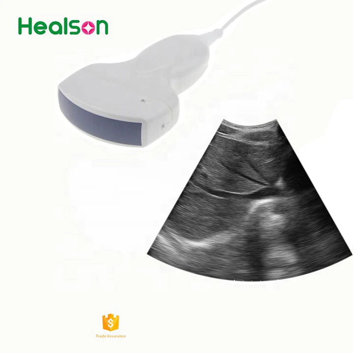 Convex Portable Ultrasound Probe