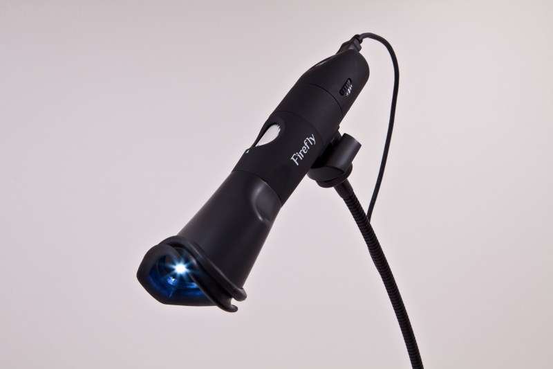 Digital Iris Scope
